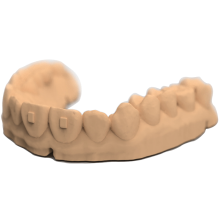 3D打印牙科树脂